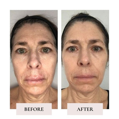 Glow Darling Anti-Aging Calcium Multi Balm Stick for Wrinkles & Hydration