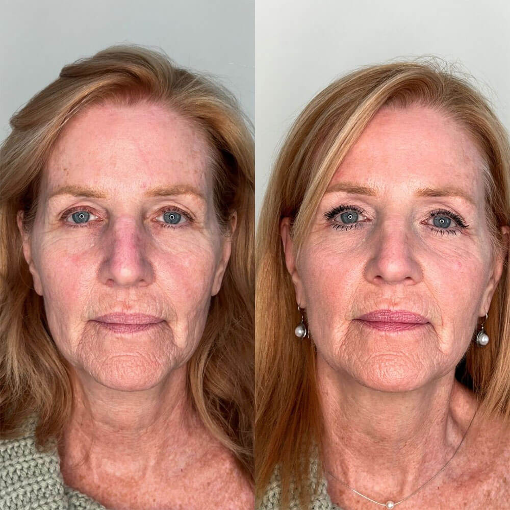 Glow Darling Anti-Aging Calcium Multi Balm Stick for Wrinkles & Hydration
