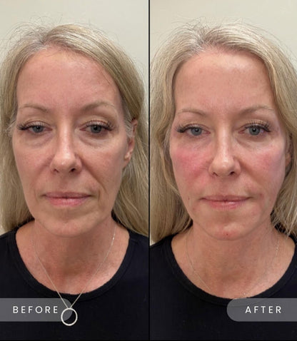 Glow Darling Anti-Aging Calcium Multi Balm Stick for Wrinkles & Hydration