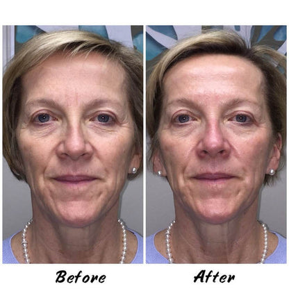 Glow Darling Anti-Aging Calcium Multi Balm Stick for Wrinkles & Hydration